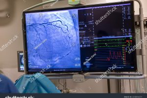 stock-photo-istanbul-turkey-september-heart-operating-room-complex-heart-surgery-cardiovascular-2238054377
